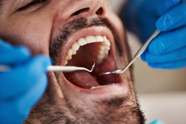 Best Emergency Root Canal Treatment in Country Club Hls, IL